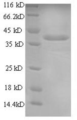 (Tris-Glycine gel) Discontinuous SDS-PAGE (reduced) with 5% enrichment gel and 15% separation gel.