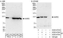 Detection of human and mouse AARS by western blot (h and m) and immunoprecipitation (h).