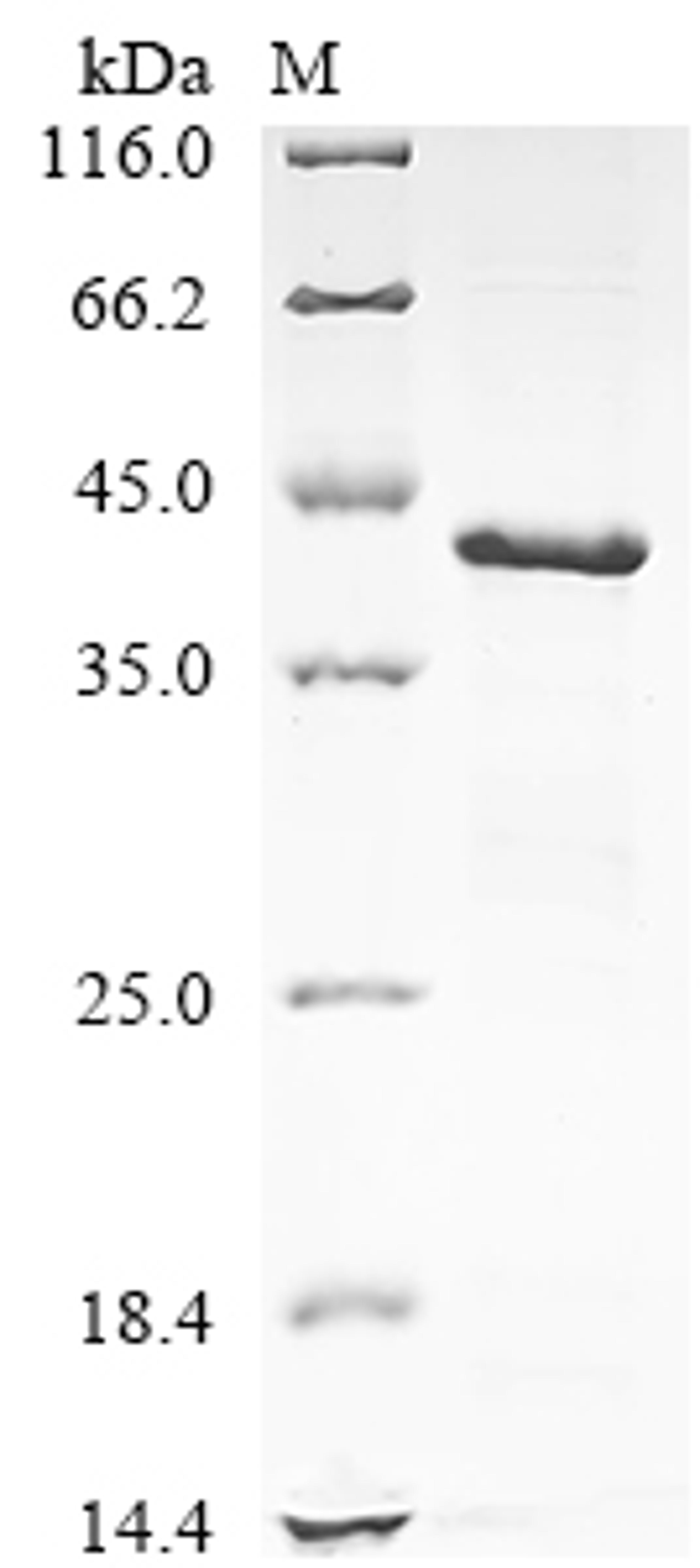 (Tris-Glycine gel) Discontinuous SDS-PAGE (reduced) with 5% enrichment gel and 15% separation gel.