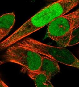 Immunocytochemistry/Immunofluorescence: SOX8 Antibody [NBP1-92425] - Staining of human cell line RH-30 shows positivity in nucleus & cytoplasm.