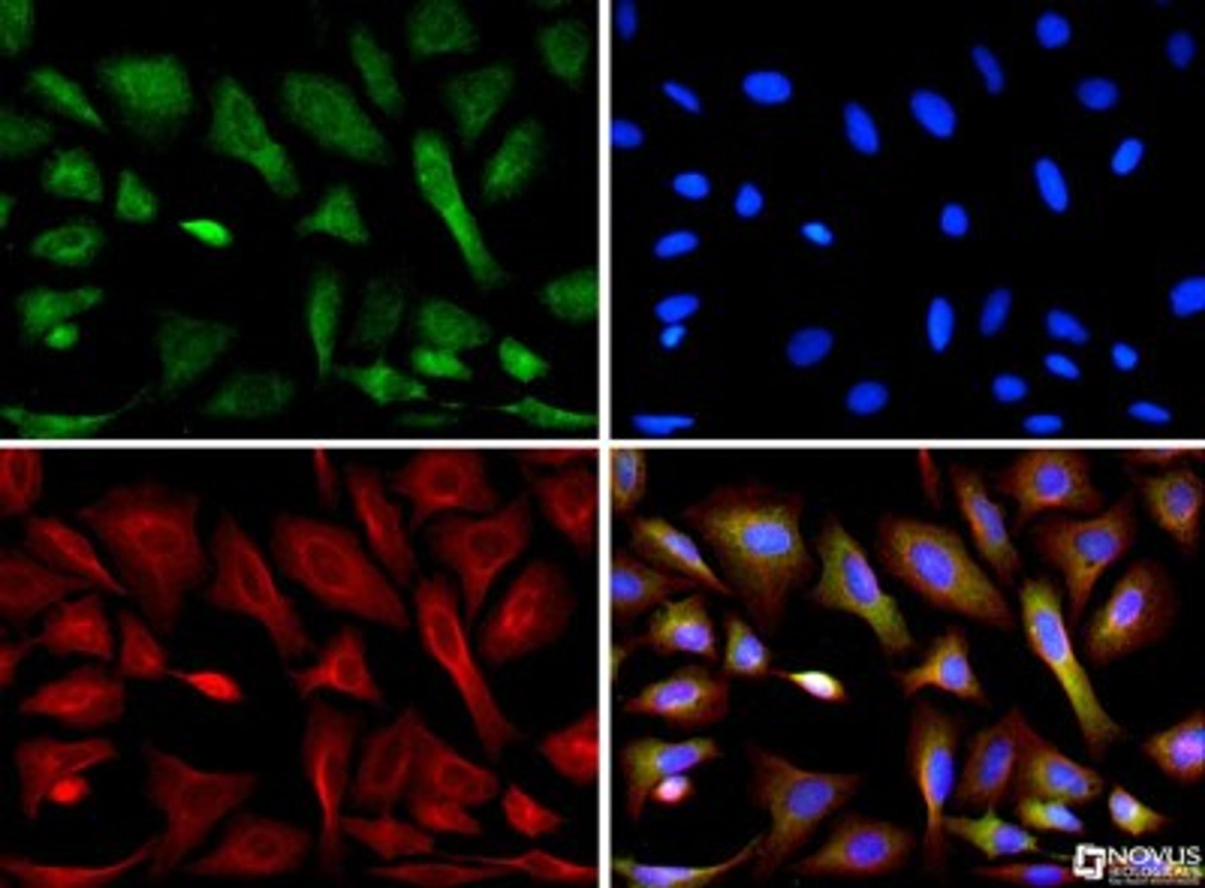 Immunocytochemistry/Immunofluorescence: CIP2A Antibody (2G10) [NB110-59722] - CIP2A antibody was tested in U2OS cells with Dylight 488 (green). Nuclei and alpha-tubulin were counterstained with DAPI (blue) and Dylight 550 (red).