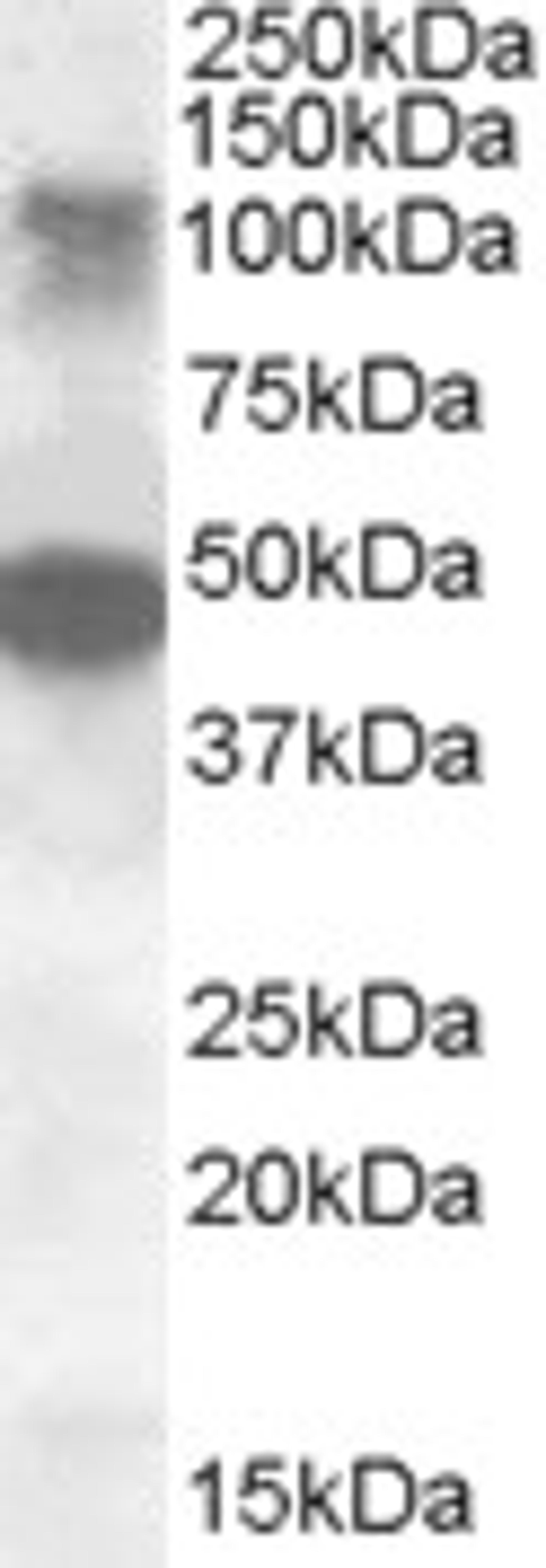 46-948 (0.5ug/ml) staining of Human Ovary lysate (35ug protein in RIPA buffer). Primary incubation was 1 hour. Detected by chemiluminescence.