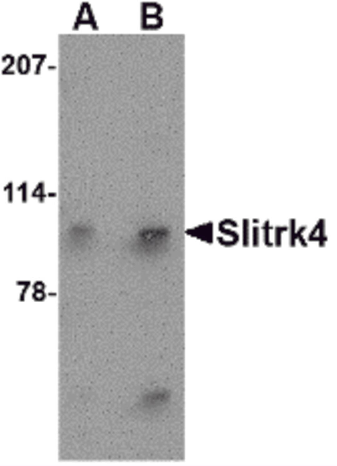 Western blot analysis of Slitrk4 in mouse brain tissue lysate with Slitrk4 antibody at (A) 0.5 and (B) 1 &#956;g/mL.