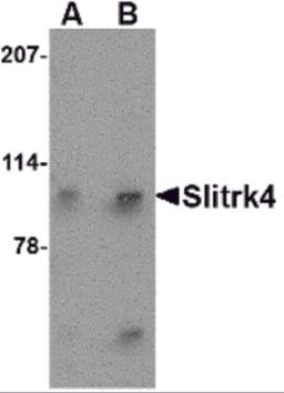 Western blot analysis of Slitrk4 in mouse brain tissue lysate with Slitrk4 antibody at (A) 0.5 and (B) 1 &#956;g/mL.