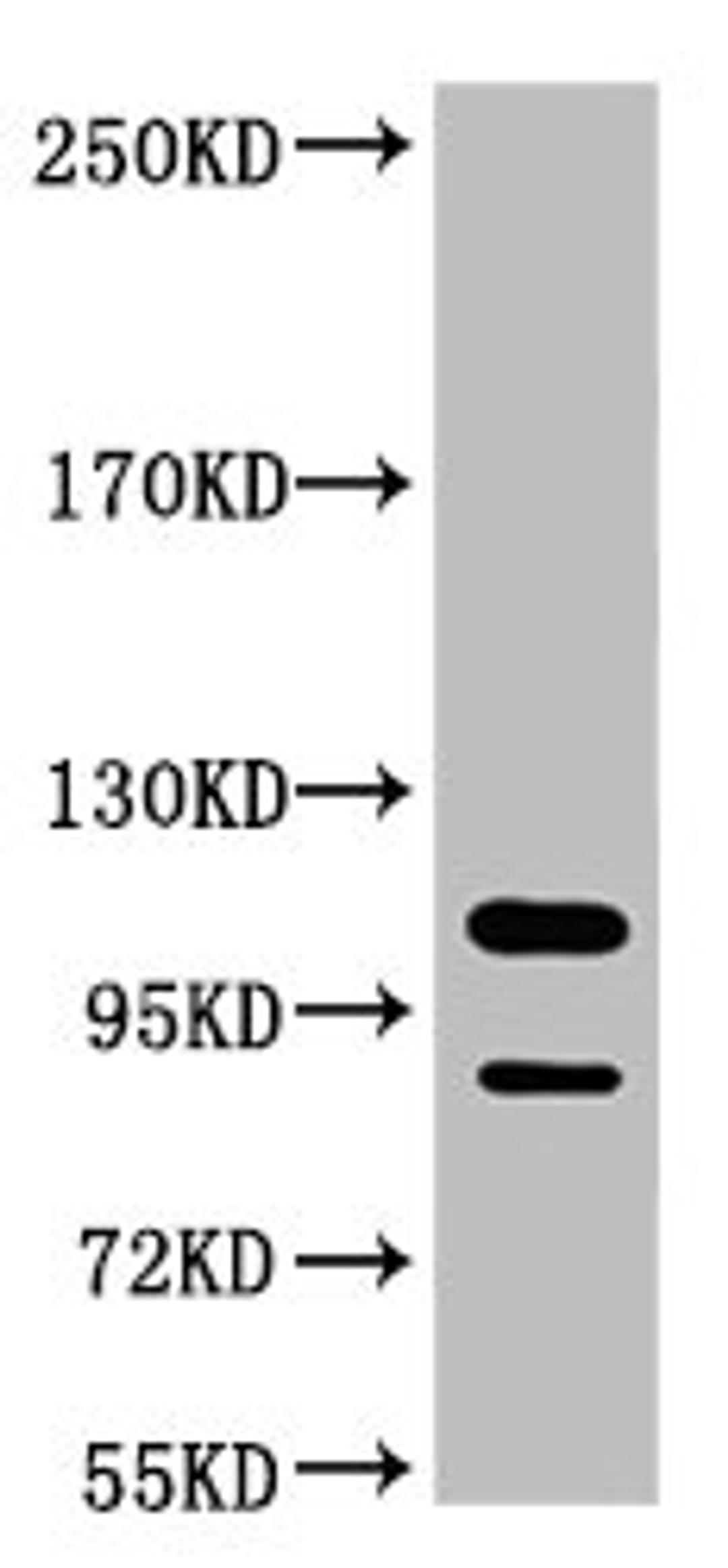Western blot analysis of Jurkat, diluted at 1:3000.