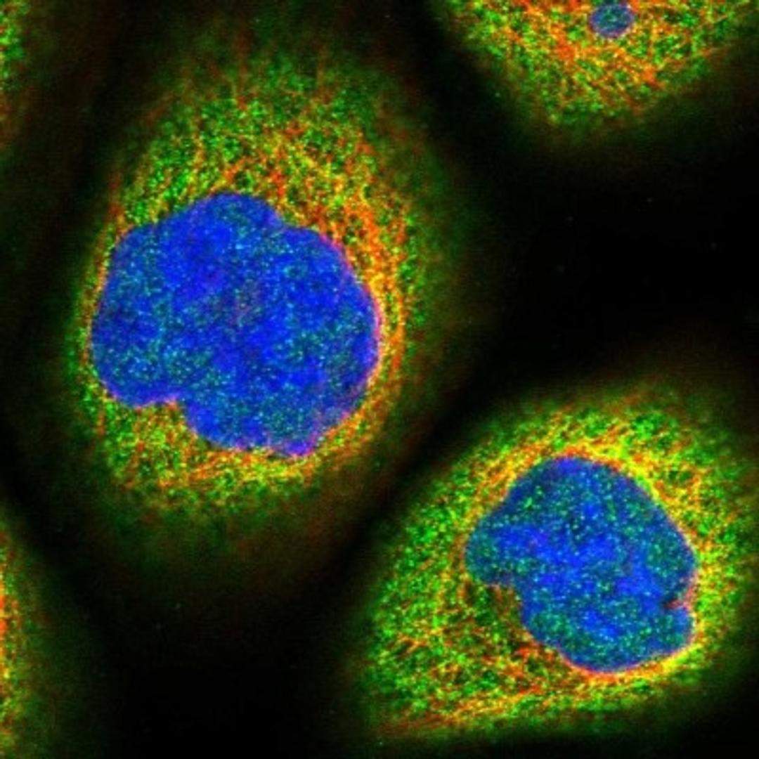 Immunocytochemistry/Immunofluorescence: MOSPD3 Antibody [NBP1-85698] - Immunofluorescent staining of human cell line A-431 shows positivity in cytoplasm.