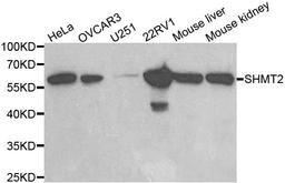 Western blot analysis of extracts of various cell lines using SHMT2 antibody