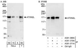 Detection of human ATXN2L by western blot and immunoprecipitation.