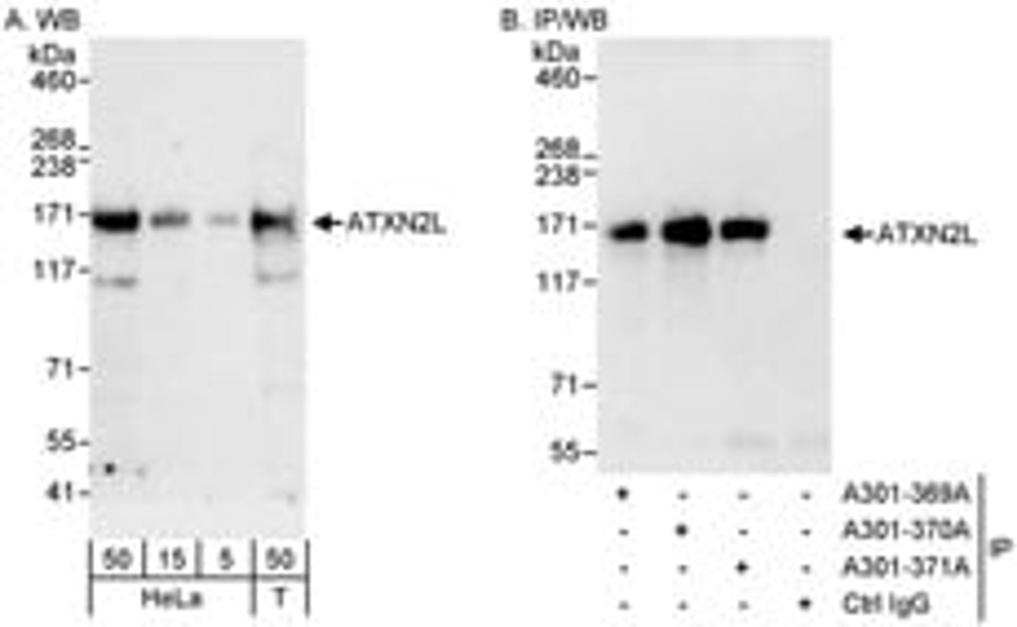 Detection of human ATXN2L by western blot and immunoprecipitation.