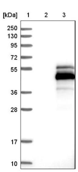 Western Blot: MAGEB1 Antibody [NBP1-85406] - Lane 1: Marker [kDa] 250, 130, 95, 72, 55, 36, 28, 17, 10<br/>Lane 2: Negative control (vector only transfected HEK293T lysate)<br/>Lane 3: Over-expression lysate (Co-expressed with a C-terminal myc-DDK tag (~3.1 kDa) in mammalian HEK293T cells, LY406154)