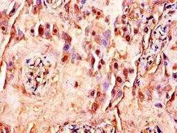 Immunohistochemistry of paraffin-embedded human placenta tissue using CSB-PA07539A0Rb at dilution of 1:100