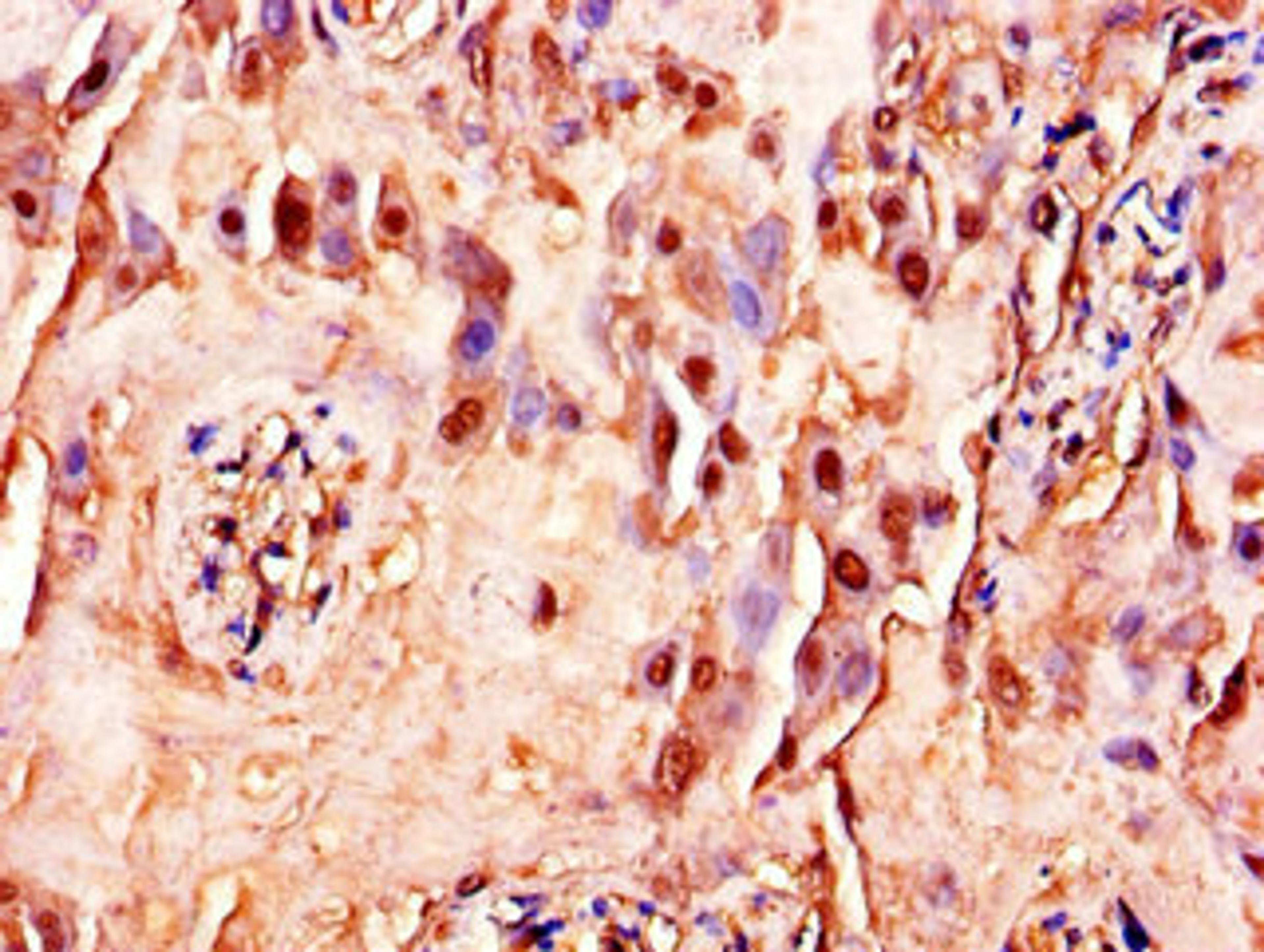 Immunohistochemistry of paraffin-embedded human placenta tissue using CSB-PA07539A0Rb at dilution of 1:100