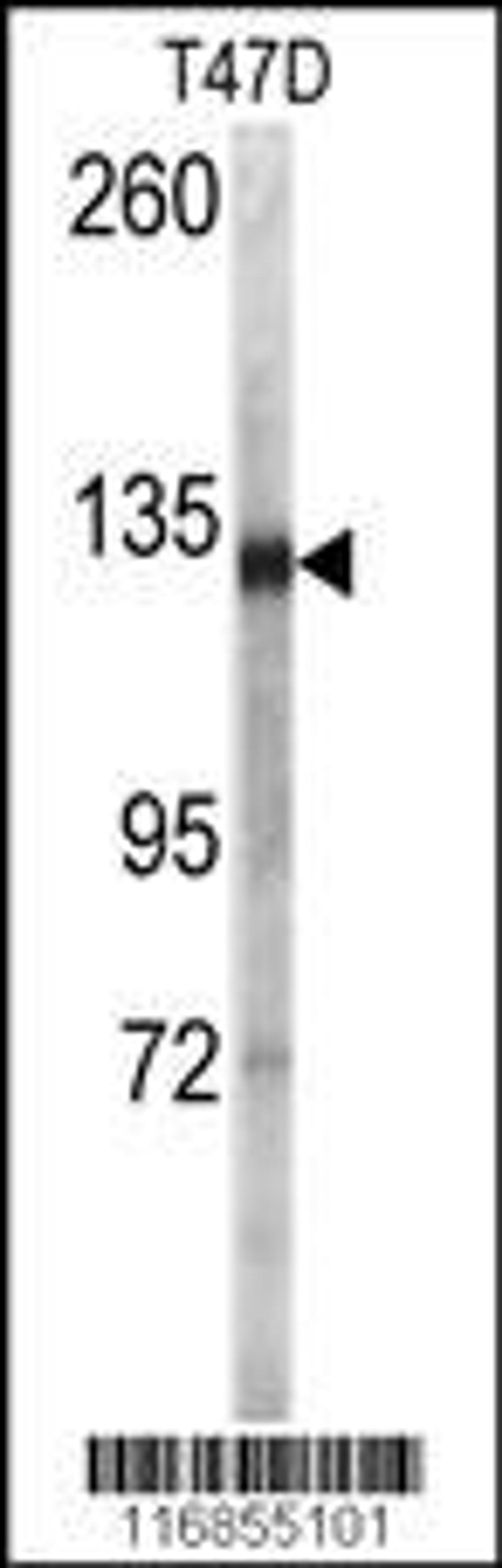 Western blot analysis of anti (AP7795a) in T47D cell line lysates (35ug/lane)