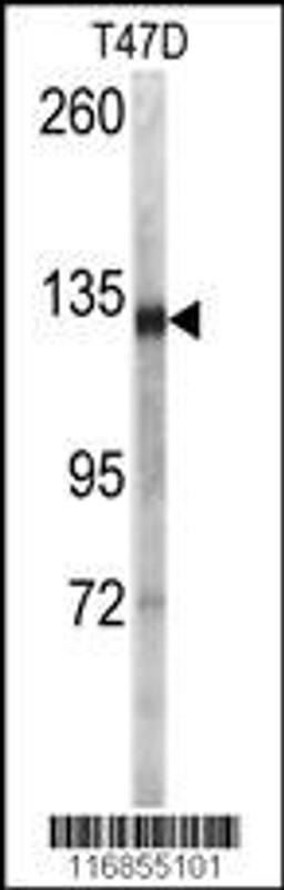 Western blot analysis of anti (AP7795a) in T47D cell line lysates (35ug/lane)