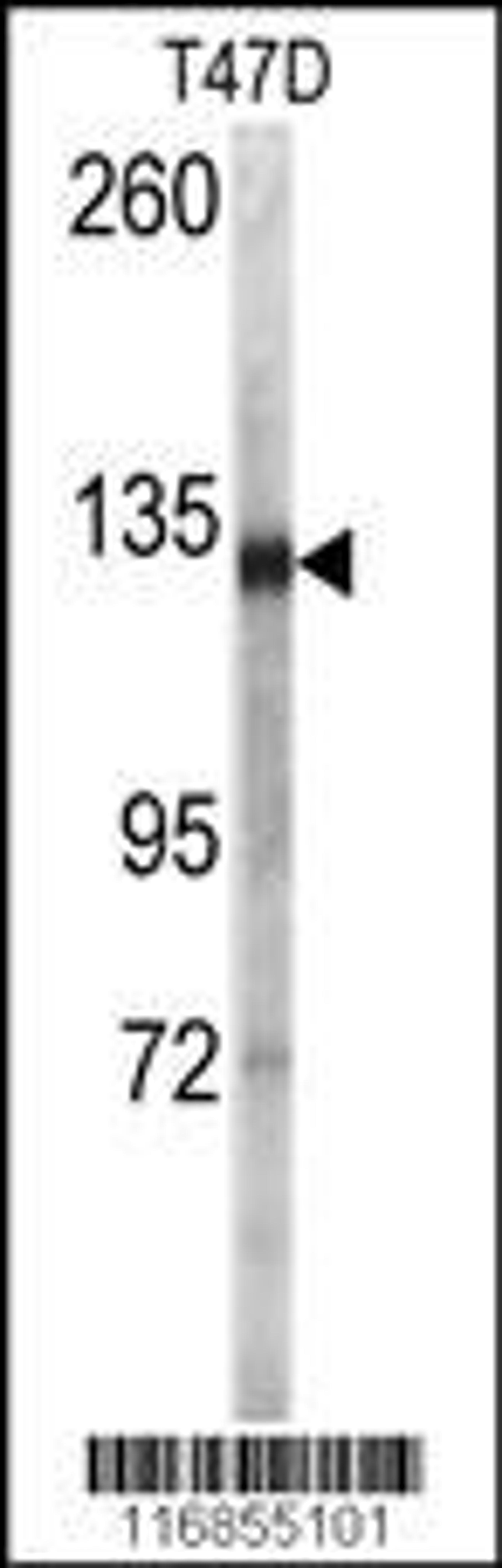 Western blot analysis of anti (AP7795a) in T47D cell line lysates (35ug/lane)