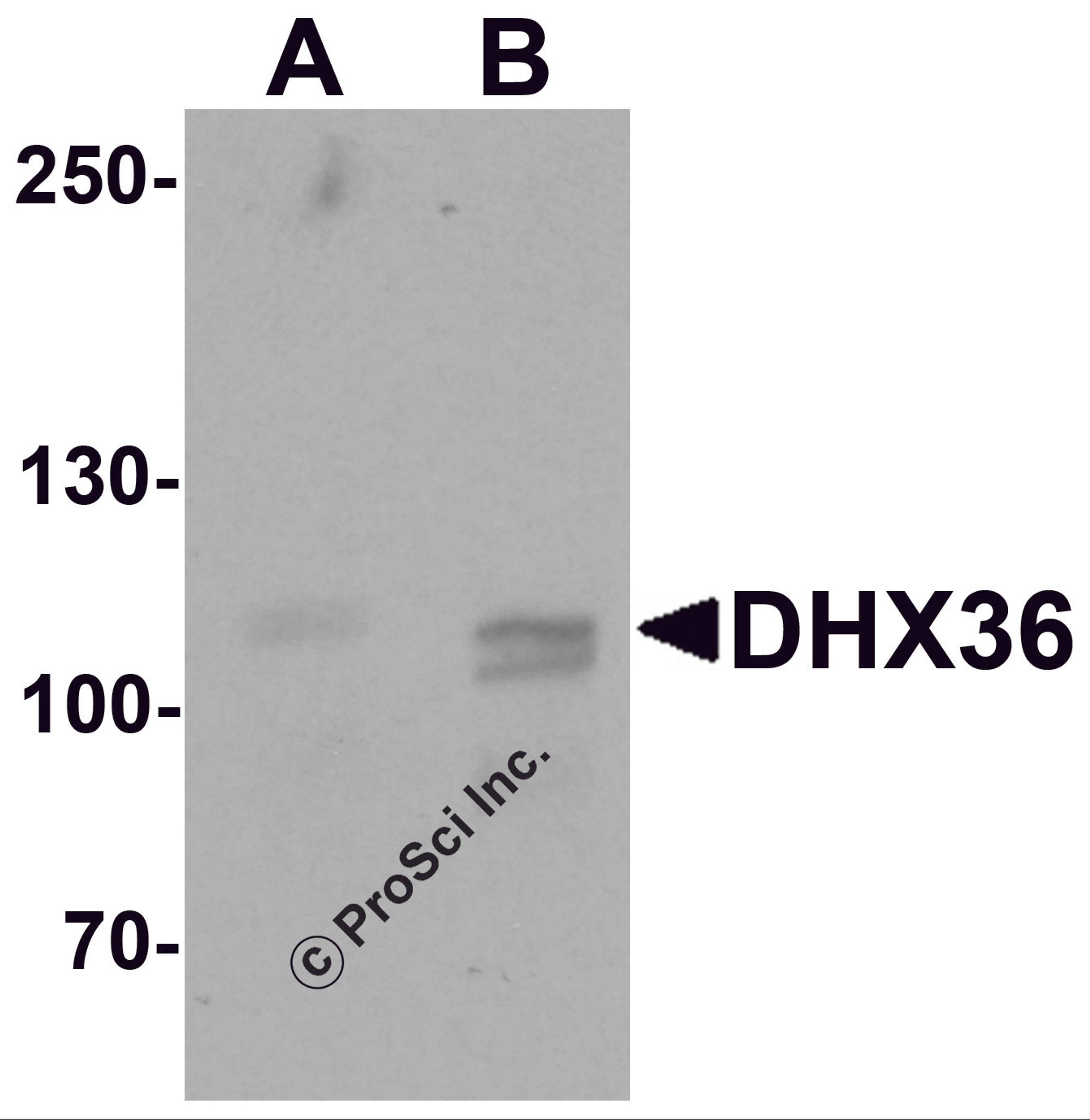 Western blot analysis of DHX36 in mouse liver tissue lysate with DHX36 antibody at (A) 0.5 and (B) 1 &#956;g/mL.