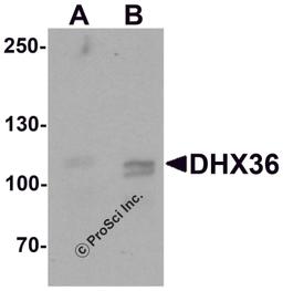 Western blot analysis of DHX36 in mouse liver tissue lysate with DHX36 antibody at (A) 0.5 and (B) 1 μg/mL.