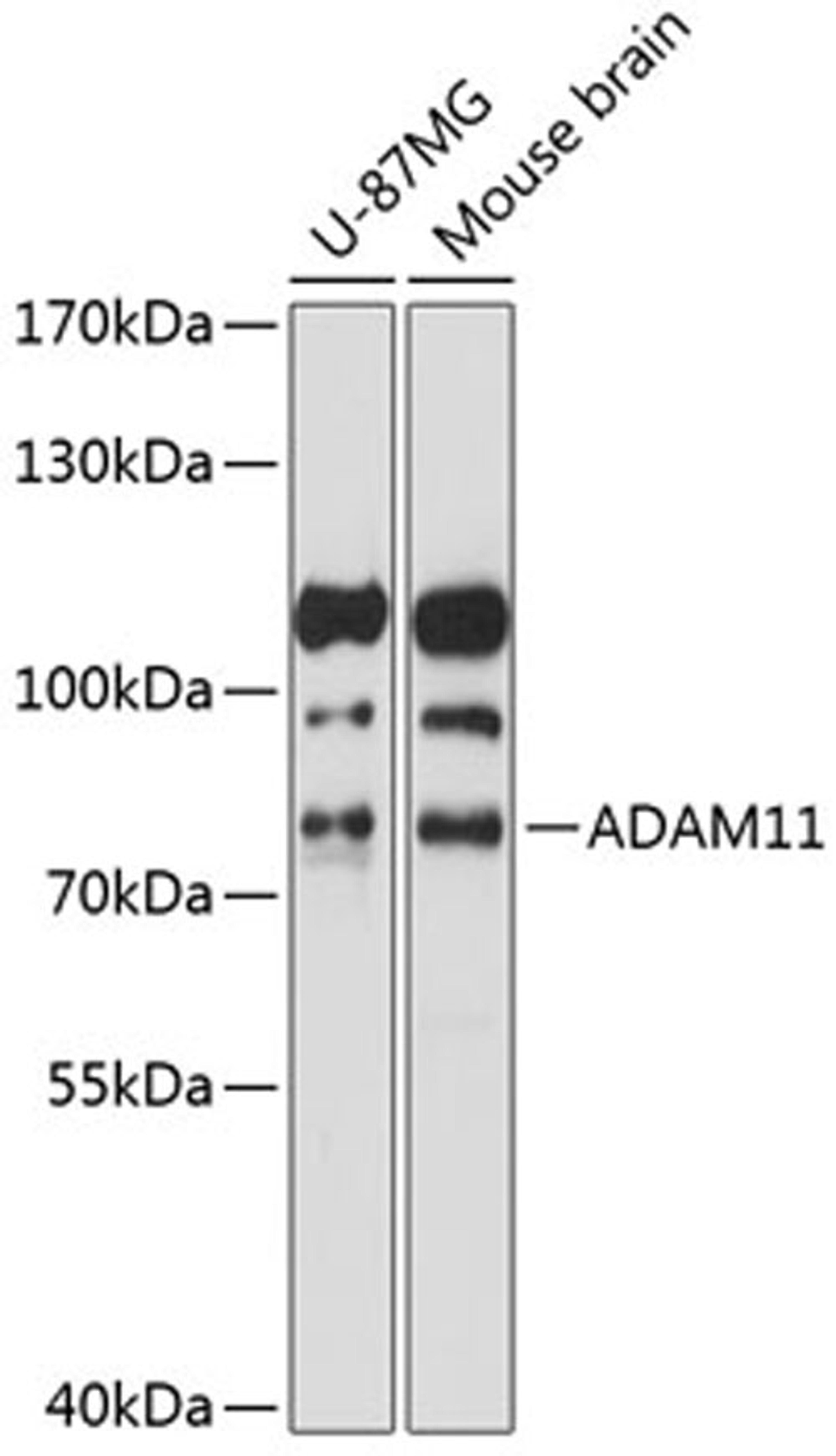 Western blot - ADAM11 antibody (A14249)