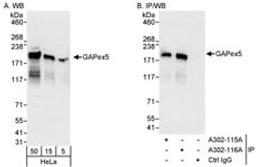 Detection of human GAPex5 by western blot and immunoprecipitation.