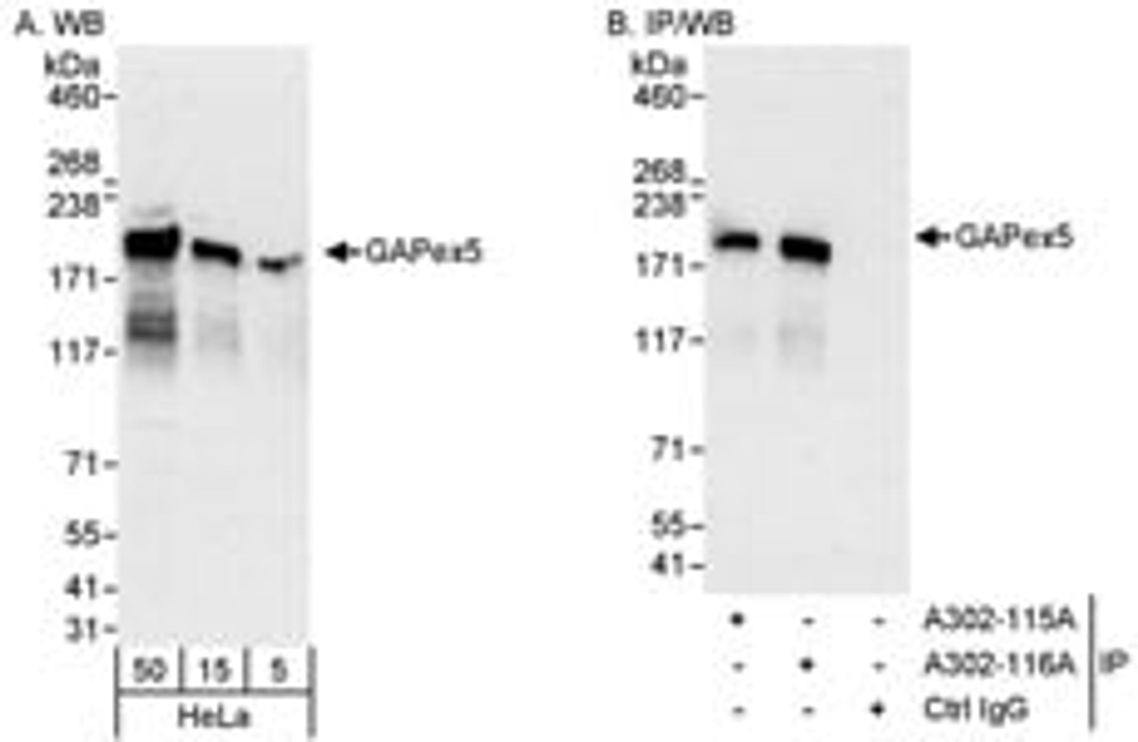 Detection of human GAPex5 by western blot and immunoprecipitation.