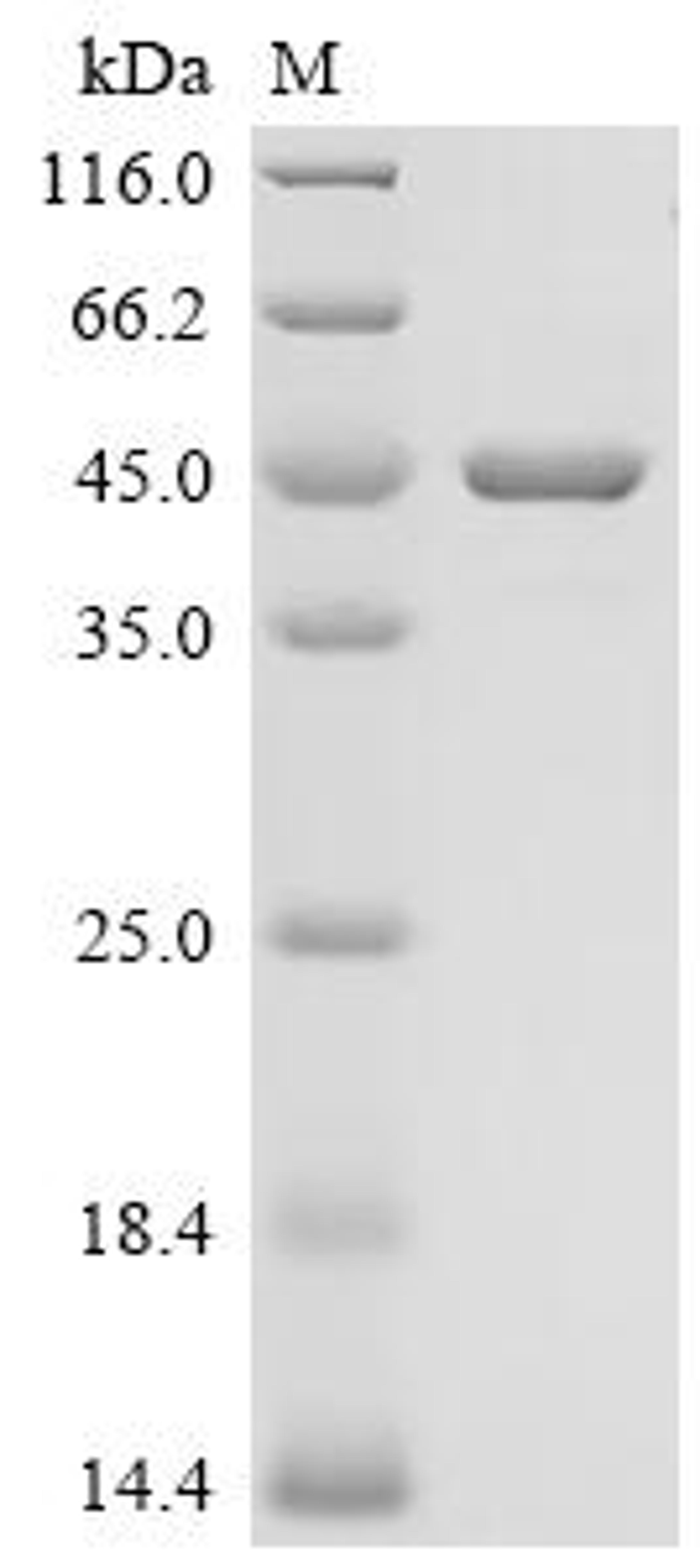 (Tris-Glycine gel) Discontinuous SDS-PAGE (reduced) with 5% enrichment gel and 15% separation gel.