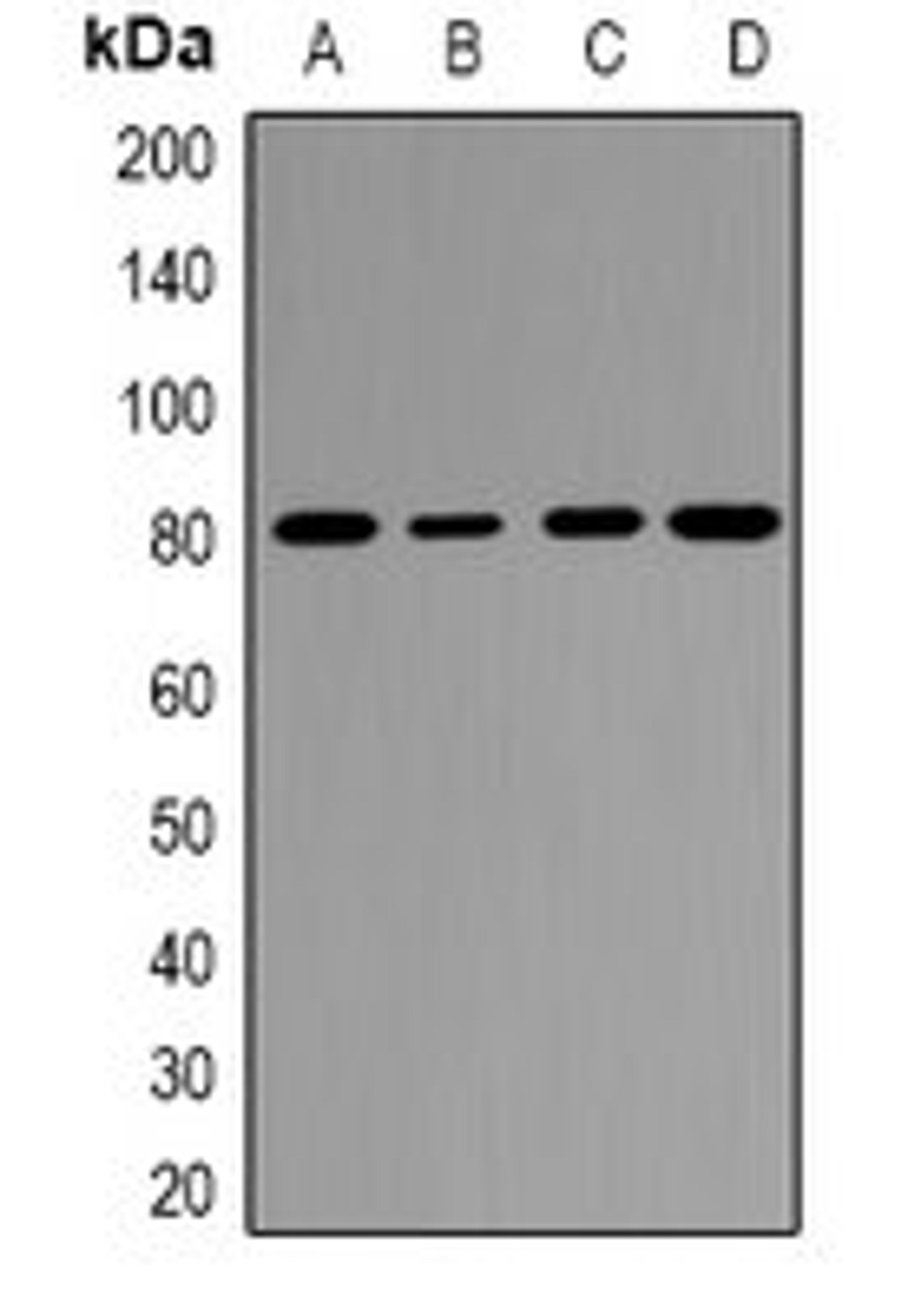 Western blot analysis of Hela (Lane1), COLO205 (Lane2), mouse uterus (Lane3), rat placenta (Lane4) whole cell lysates using EPS8L1 antibody