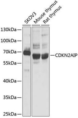 Western blot - CDKN2AIP antibody (A3233)