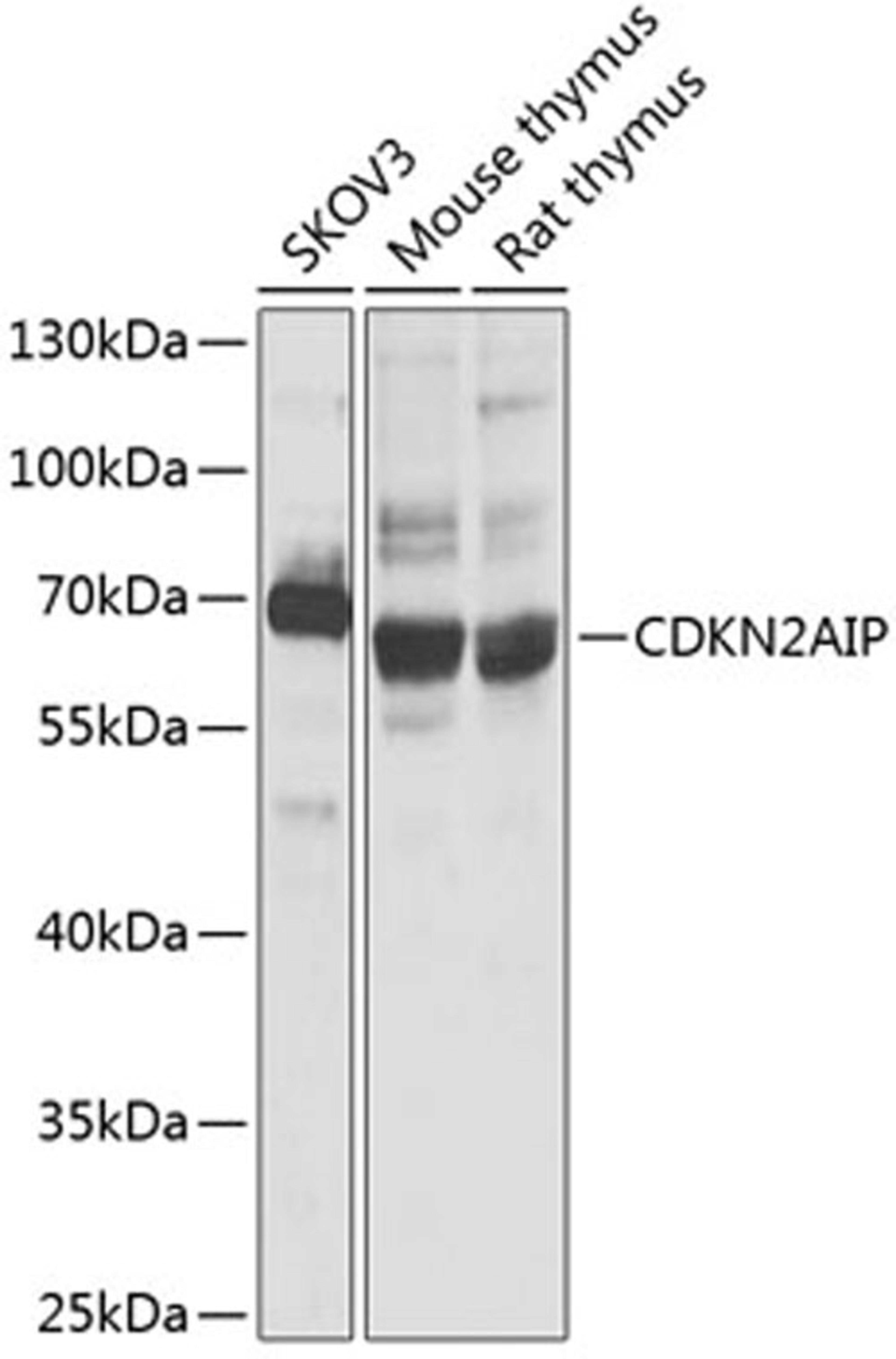 Western blot - CDKN2AIP antibody (A3233)