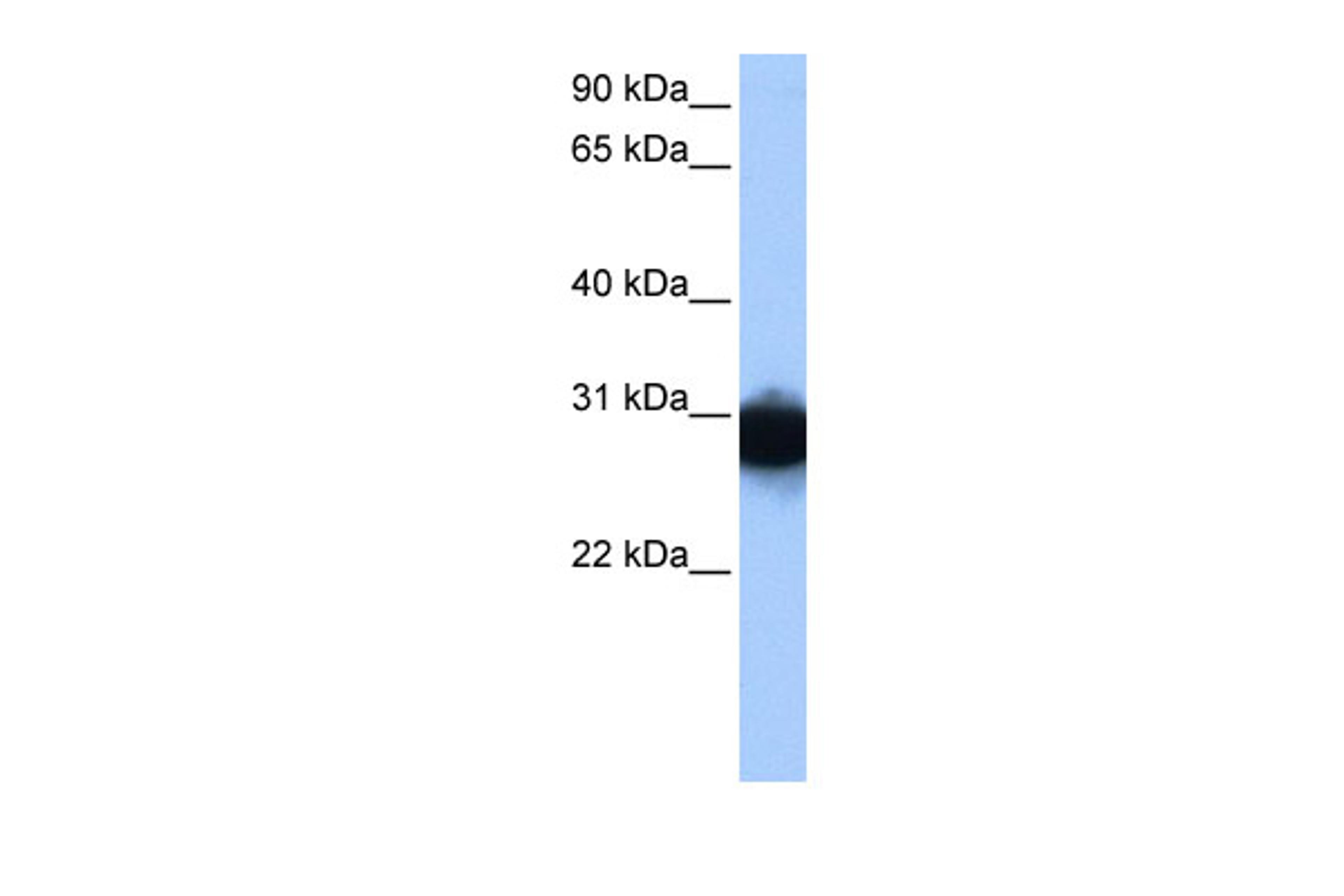 Antibody used in WB on Human HepG2 at 0.2-1 ug/ml.