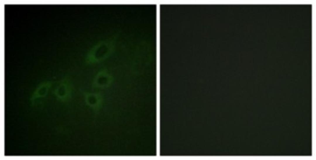 Immunocytochemistry/Immunofluorescence: JAK3 Antibody [NBP1-61704] - Analysis of A549 cells, using JAK3  Antibody. The picture on the right is treated with the synthesized peptide.