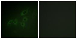 Immunocytochemistry/Immunofluorescence: JAK3 Antibody [NBP1-61704] - Analysis of A549 cells, using JAK3  Antibody. The picture on the right is treated with the synthesized peptide.