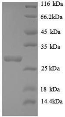(Tris-Glycine gel) Discontinuous SDS-PAGE (reduced) with 5% enrichment gel and 15% separation gel.