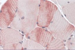 Immunohistochemistry of MYBPC1 in human skeletal muscle tissue with MYBPC1 antibody at 5 &#956;g/mL.