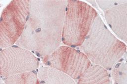 Immunohistochemistry of MYBPC1 in human skeletal muscle tissue with MYBPC1 antibody at 5 μg/mL.