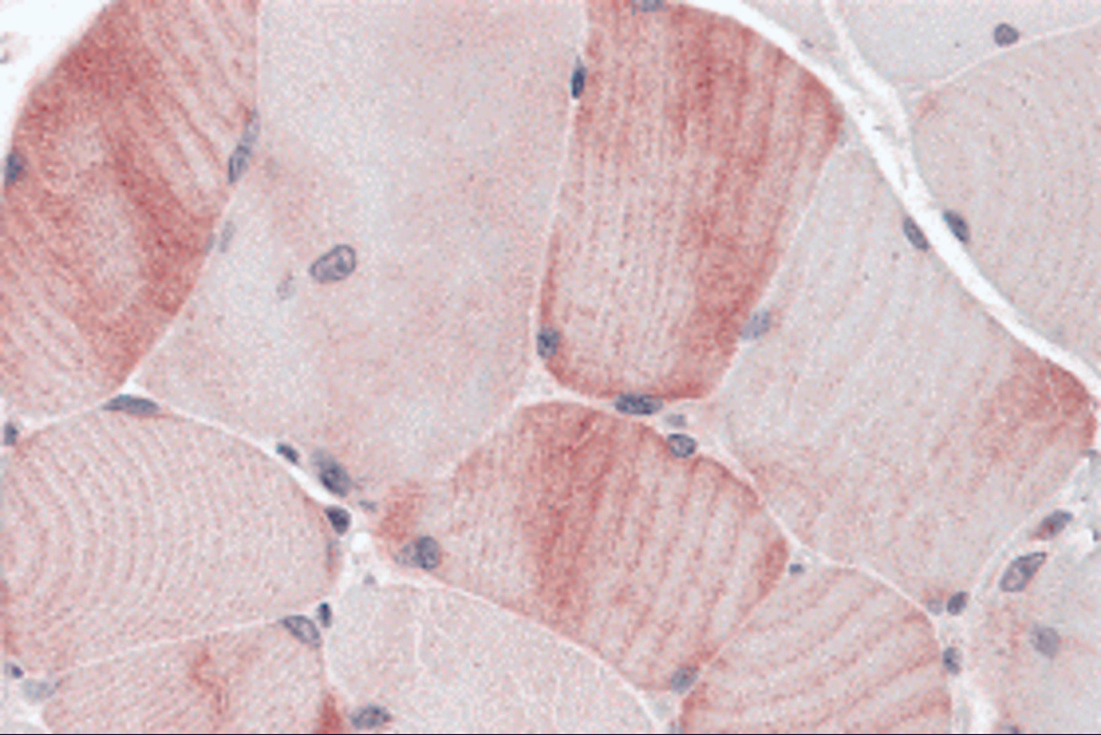 Immunohistochemistry of MYBPC1 in human skeletal muscle tissue with MYBPC1 antibody at 5 μg/mL.