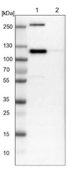 Western Blot: KANK2 Antibody [NBP1-89080] - Lane 1: NIH-3T3 cell lysate (Mouse embryonic fibroblast cells)<br/>Lane 2: NBT-II cell lysate (Rat Wistar bladder tumour cells)