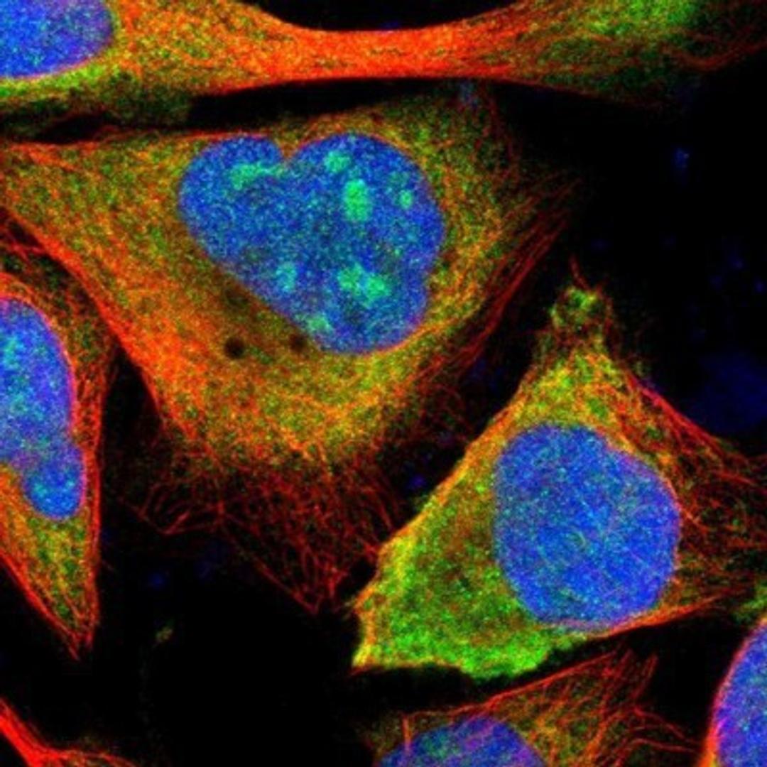 Immunocytochemistry/Immunofluorescence: ETV6/Tel Antibody [NBP1-80695] - Staining of human cell line U-2 OS shows positivity in nucleoli & cytoplasm.