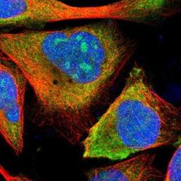 Immunocytochemistry/Immunofluorescence: ETV6/Tel Antibody [NBP1-80695] - Staining of human cell line U-2 OS shows positivity in nucleoli & cytoplasm.