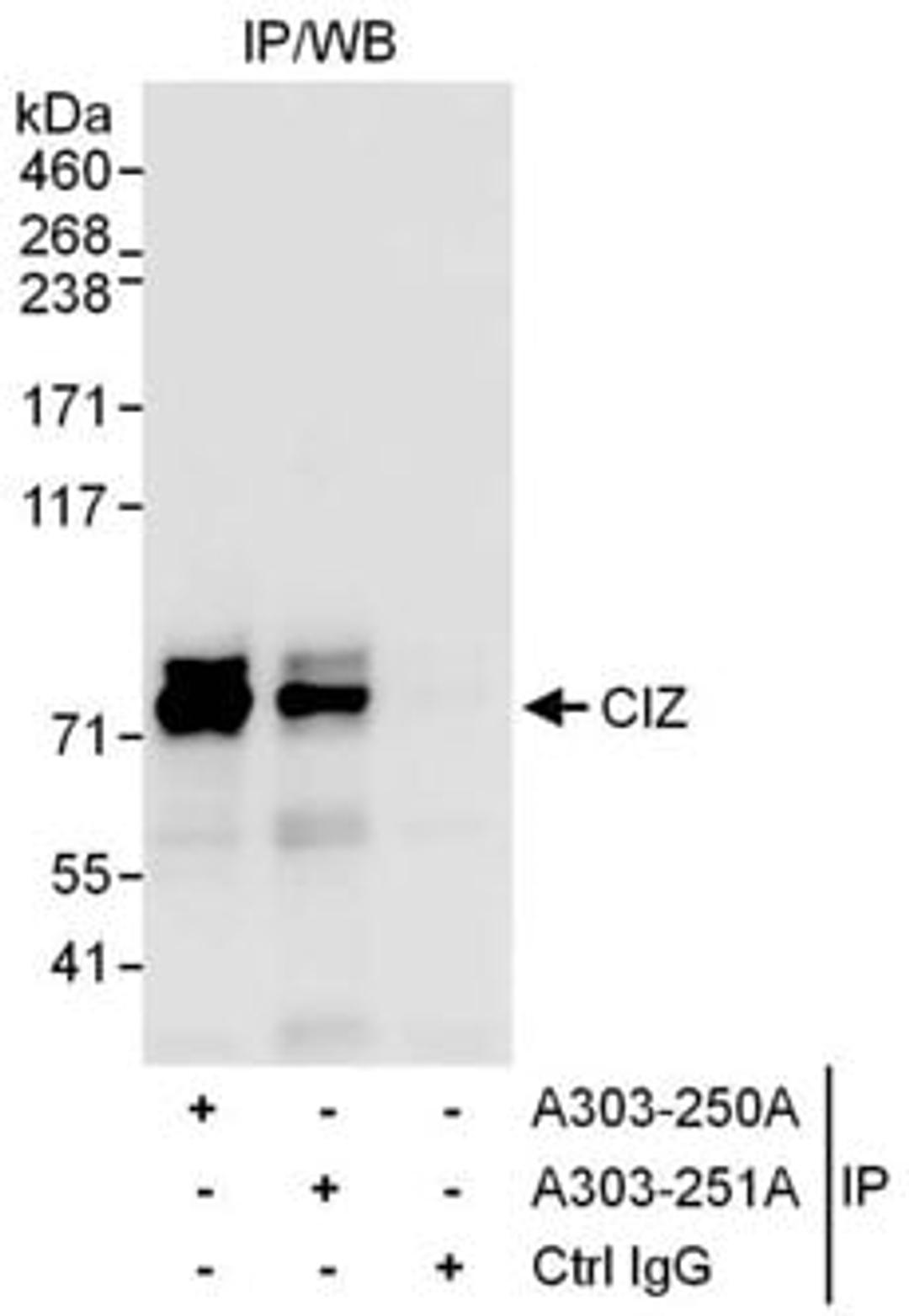 Detection of human CIZ by western blot of immunoprecipitates.