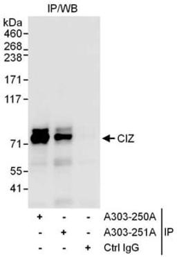 Detection of human CIZ by western blot of immunoprecipitates.