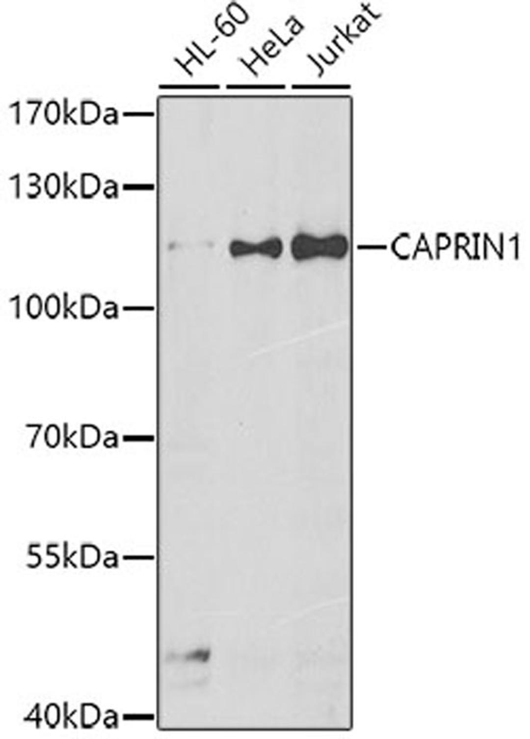 Western blot - CAPRIN1 antibody (A7910)