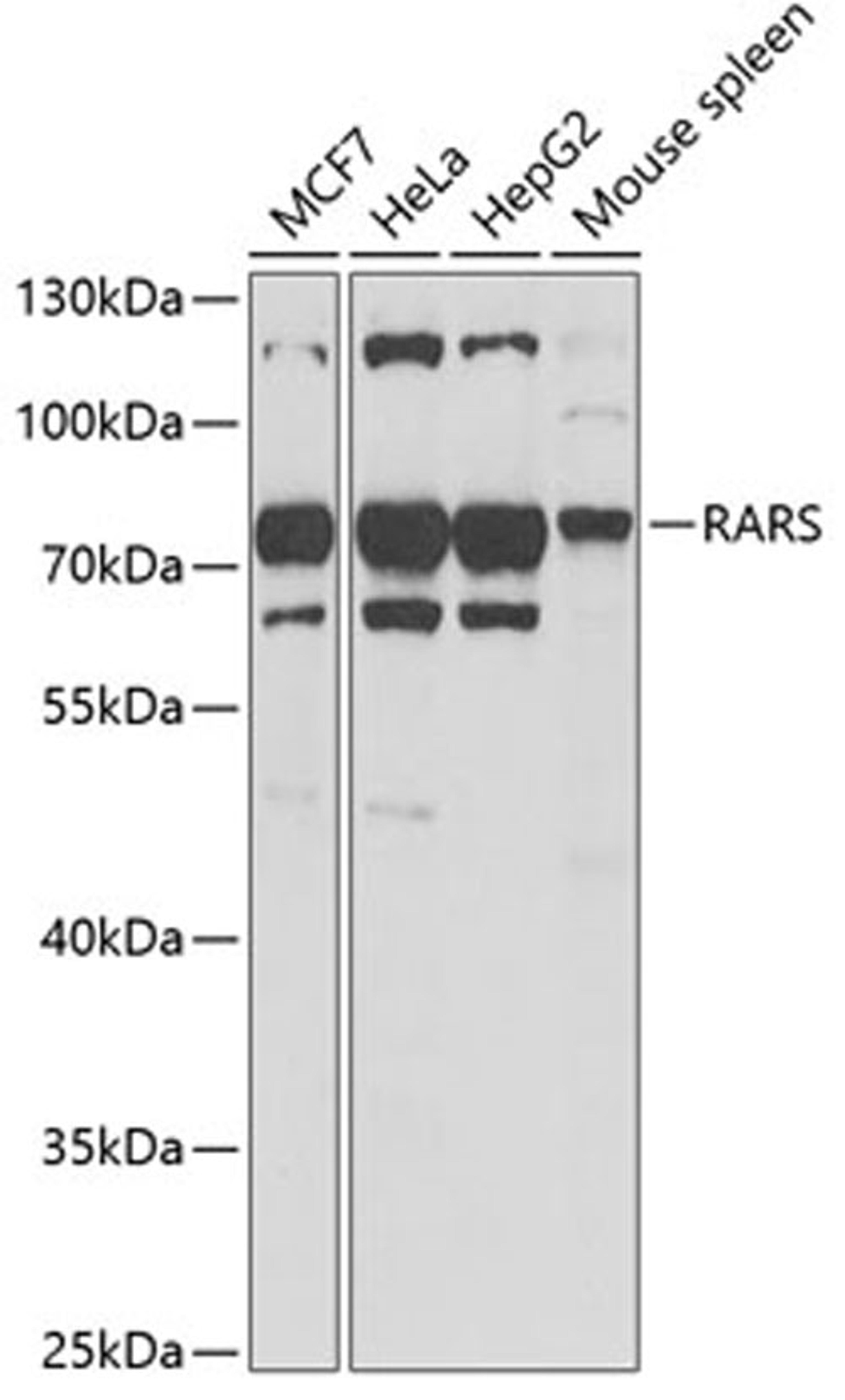 Western blot - RARS antibody (A6307)