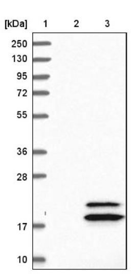 Western Blot: ECRG4 Antibody [NBP1-84911] - Lane 1: Marker [kDa] 250, 130, 95, 72, 55, 36, 28, 17, 10<br/>Lane 2: Negative control (vector only transfected HEK293T lysate)<br/>Lane 3: Over-expression lysate (Co-expressed with a C-terminal myc-DDK tag (~3.1 kDa) in mammalian HEK293T cells, LY403168)