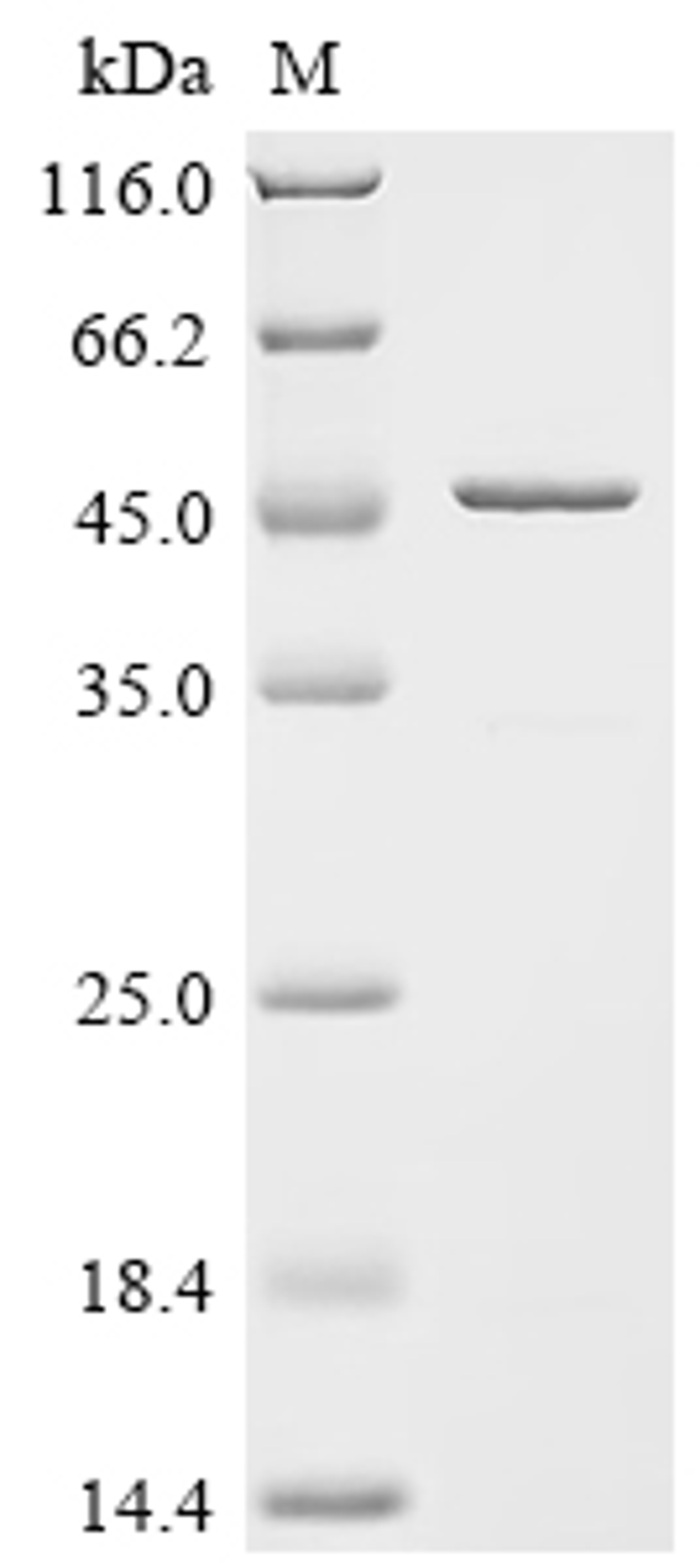 (Tris-Glycine gel) Discontinuous SDS-PAGE (reduced) with 5% enrichment gel and 15% separation gel.