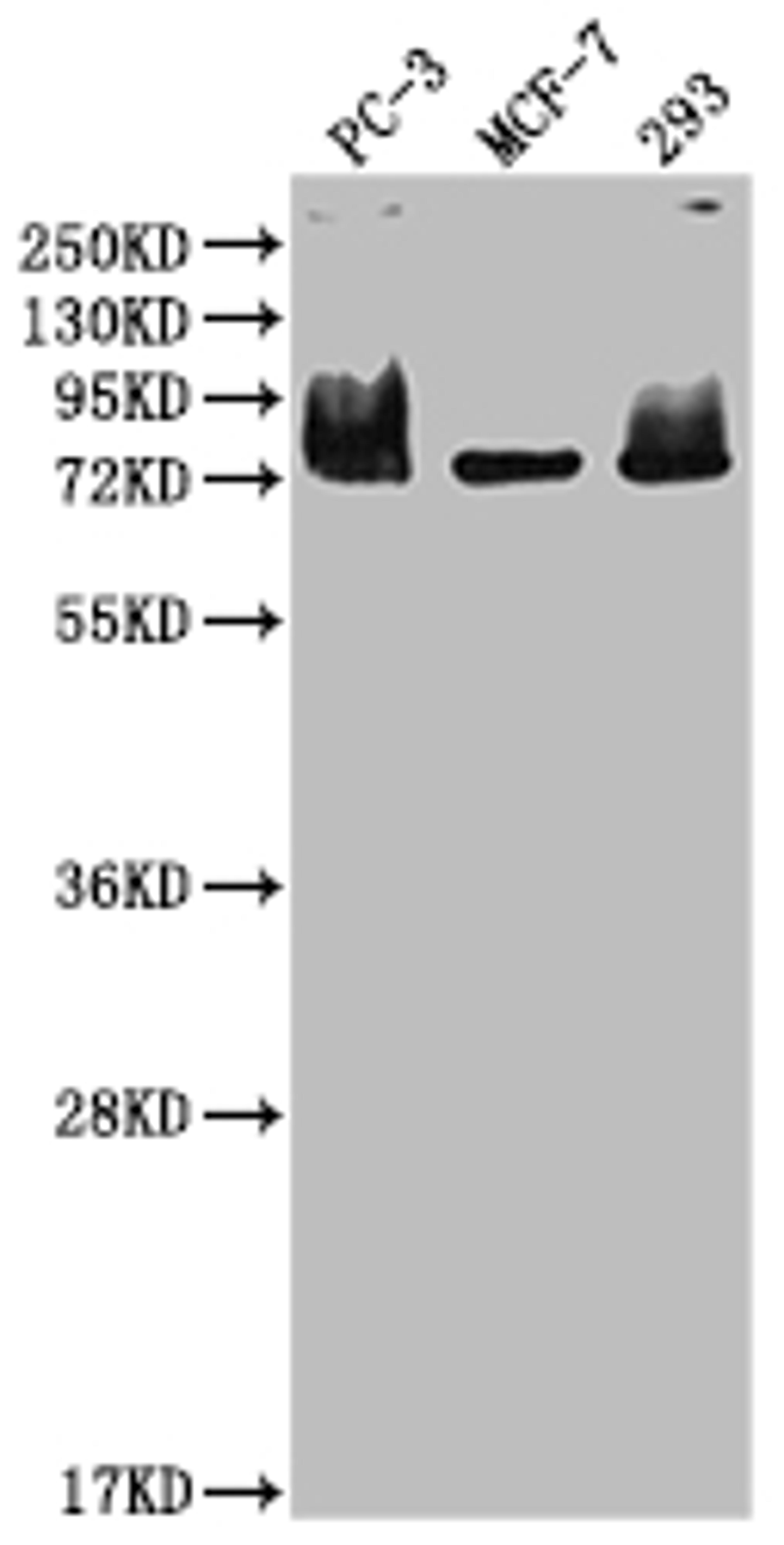 Western Blot. Positive WB detected in: PC-3 whole cell lysate, MCF-7 whole cell lysate, 293 whole cell lysate. All lanes: MEN1 antibody at 1:2000. Secondary. Goat polyclonal to rabbit IgG at 1/50000 dilution. Predicted band size: 69, 68, 64 kDa. Observed band size: 75 kDa. 