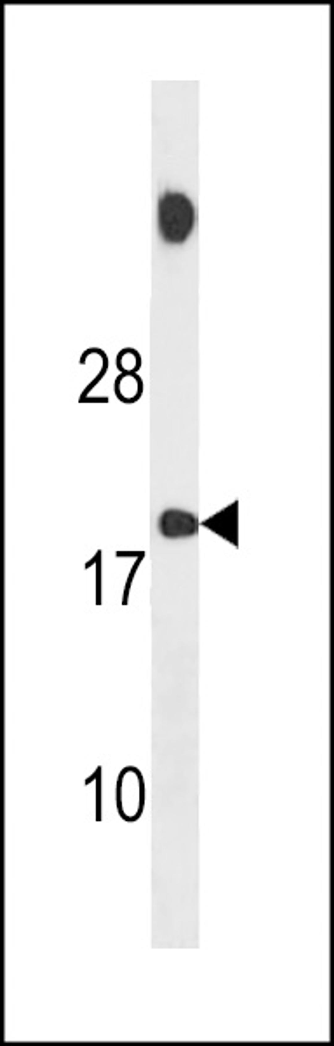 Western blot analysis in MDA-MB231 cell line lysates (35ug/lane).