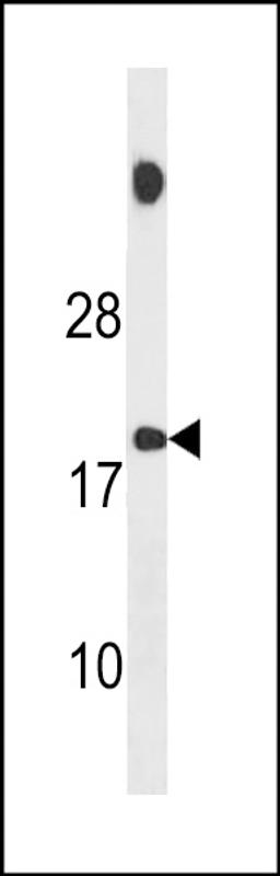 Western blot analysis in MDA-MB231 cell line lysates (35ug/lane).