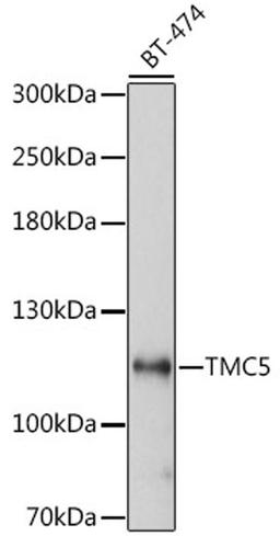 Western blot - TMC5 antibody (A16144)