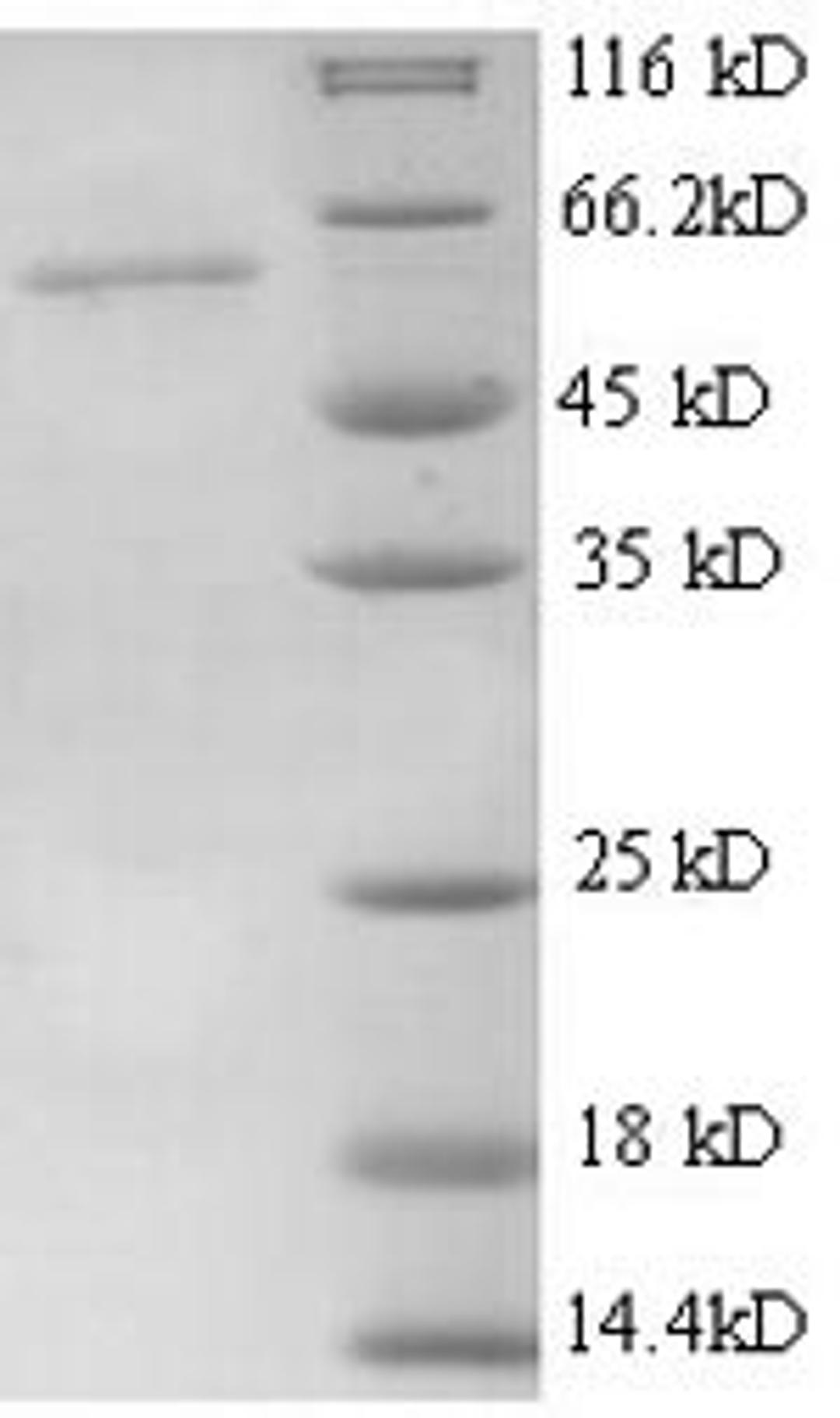 (Tris-Glycine gel) Discontinuous SDS-PAGE (reduced) with 5% enrichment gel and 15% separation gel.