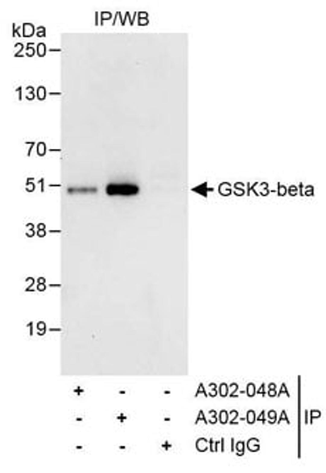 Detection of human GSK3-beta by western blot of immunoprecipitates.